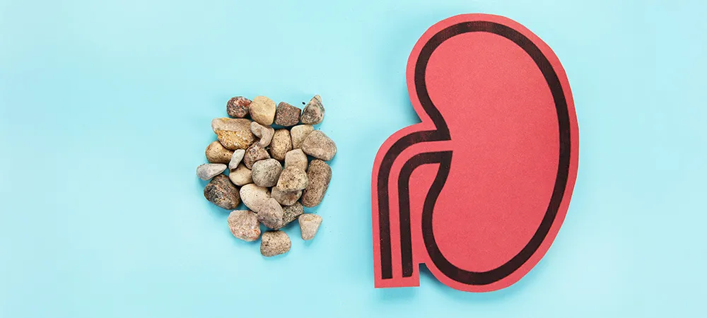 Hangi bitki böbrek taşını eritir? Böbrek taşı en hızlı nasıl düşer?